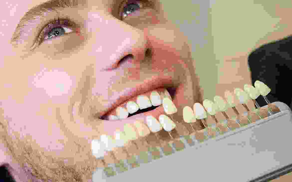 Dental Bridges Dental Bridges