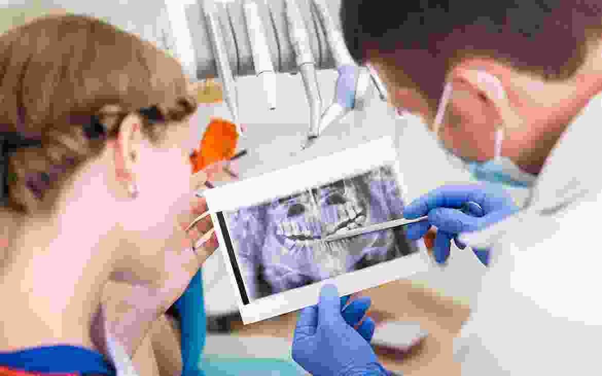 Invisalign Invisalign